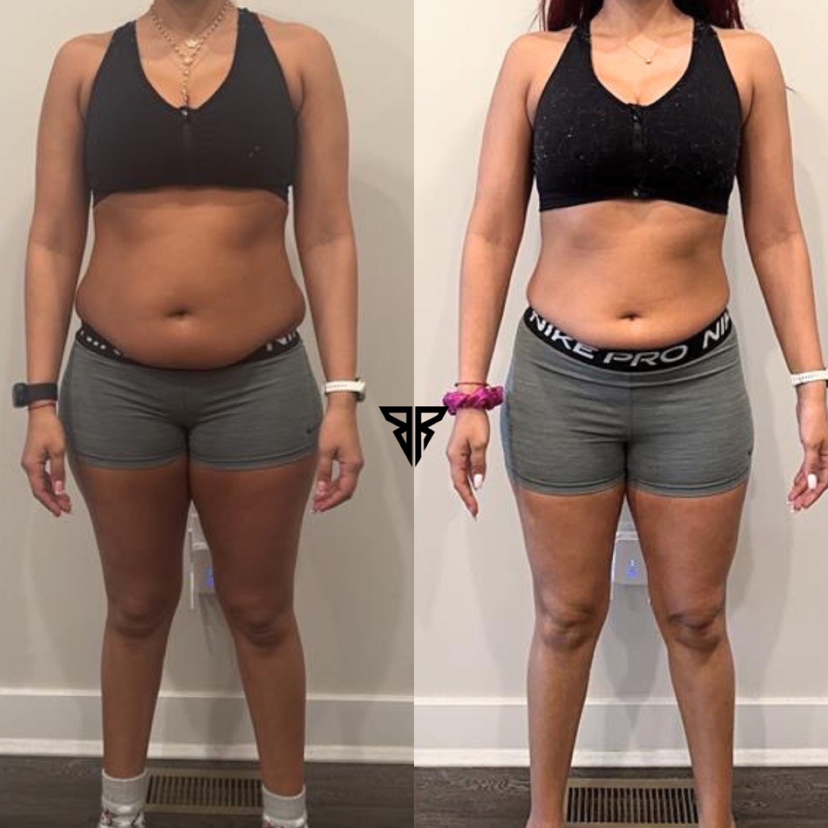 Roxie, five month body recomposition